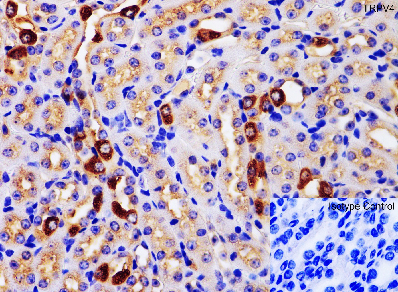 Immunohistochemistry of TRPV4