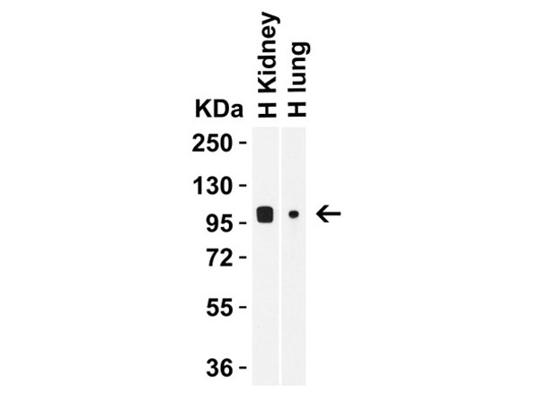 Western Blot of TRPV4