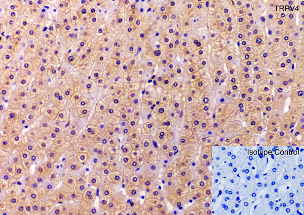Immunohistochemistry of TRPV4