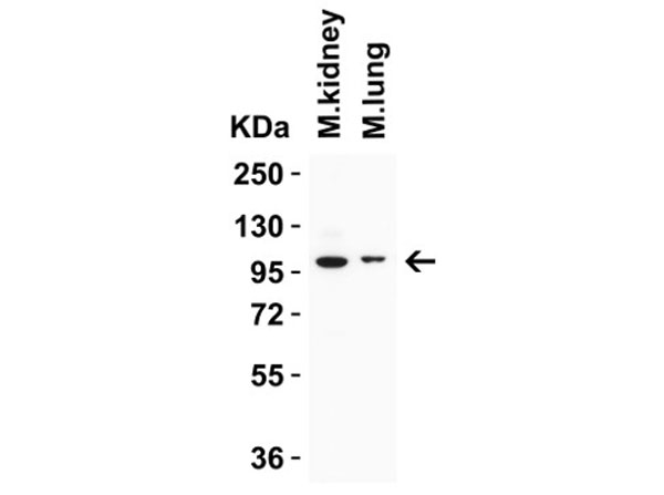 Western Blot of TRPV4