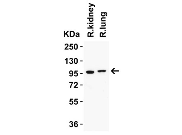 Western Blot of TRPV4