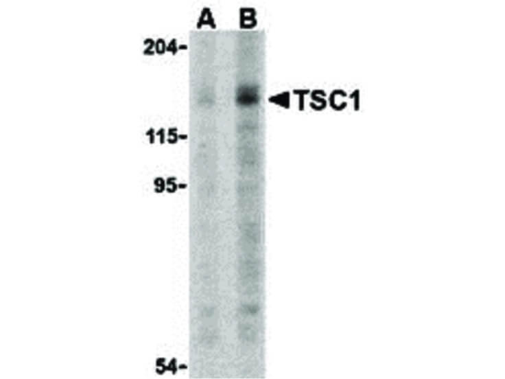 Western Blot of TSC1 Antibody