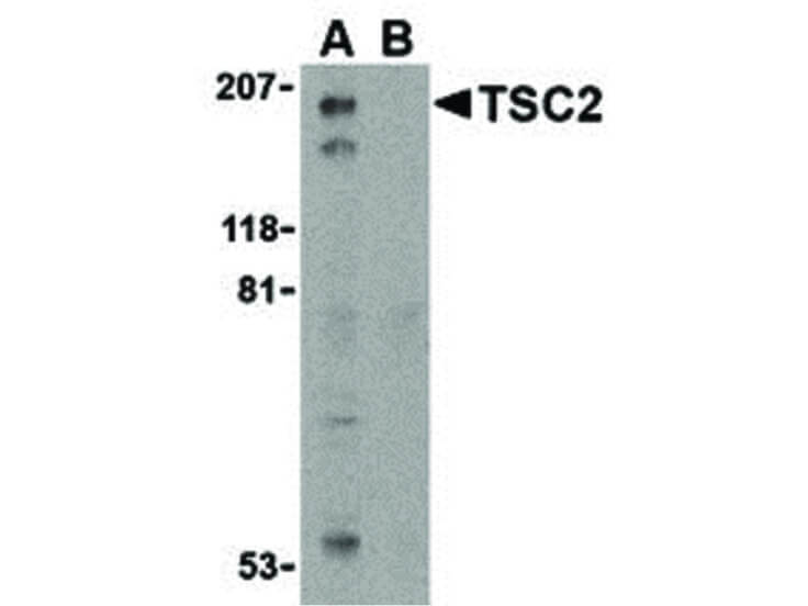 Western Blot of TSC2 Antibody