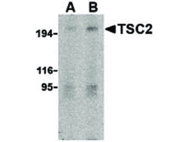 Western Blot of TSC2 Antibody