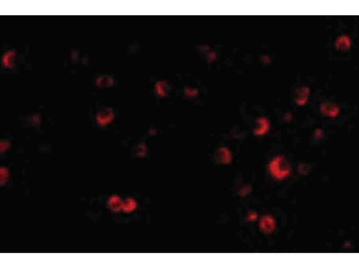 Immunofluorescence of TSC2 Antibody