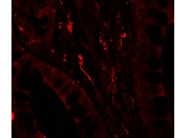 Immunofluorescence of TSC22D3