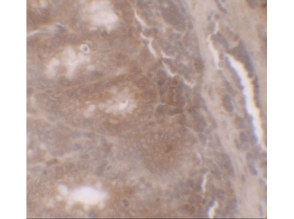 Immunohistochemistry of TSC22D3