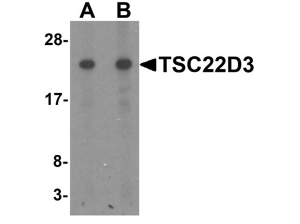 Western blot analysis of TSC22D3