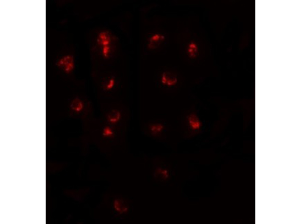 Immunofluorescence of TSHZ1