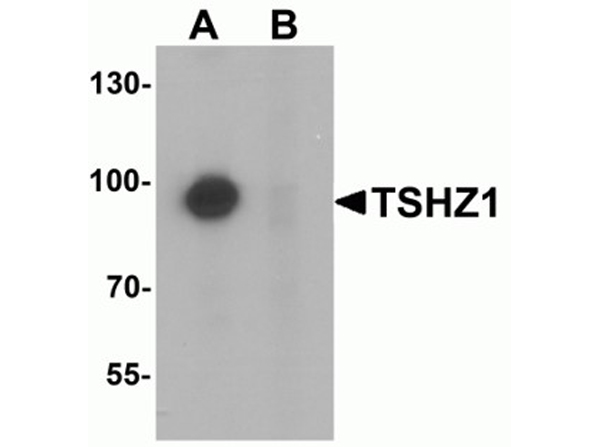 Western blot analysis of TSHZ1