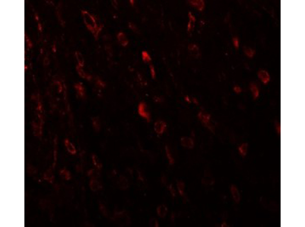 Immunofluorescence of TSHZ3