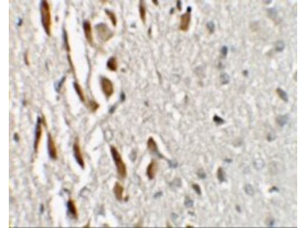 Immunohistochemistry of TSHZ3