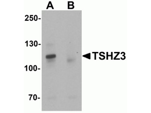 Western blot analysis of TSHZ3