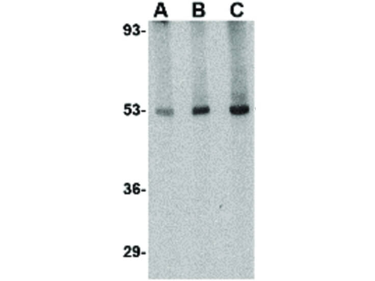 Western Blot of TSLP Receptor Antibody