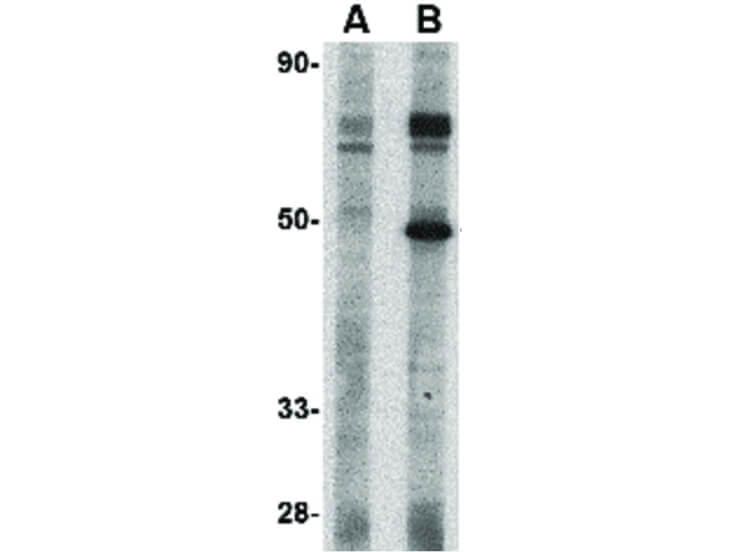 Western Blot of TSLP Receptor Antibody