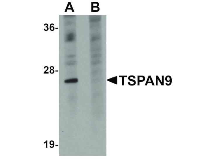 Western Blot of TSPAN9 Antibody
