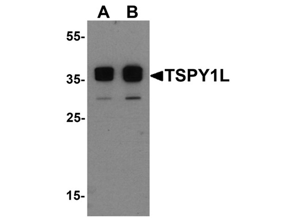 Western blot analysis of TSPY1L
