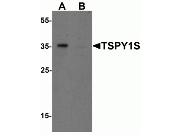 Western blot analysis of TSPY1S