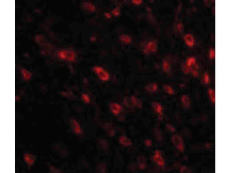 Immunofluorescence of TTBK1 Antibody