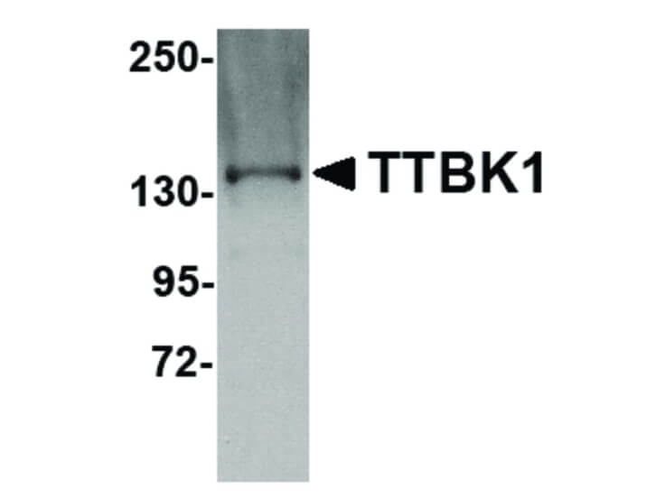 Western Blot of TTBK1 Antibody