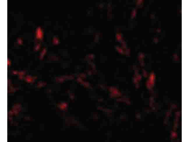 Immunofluorescence of TTC5 Antibody