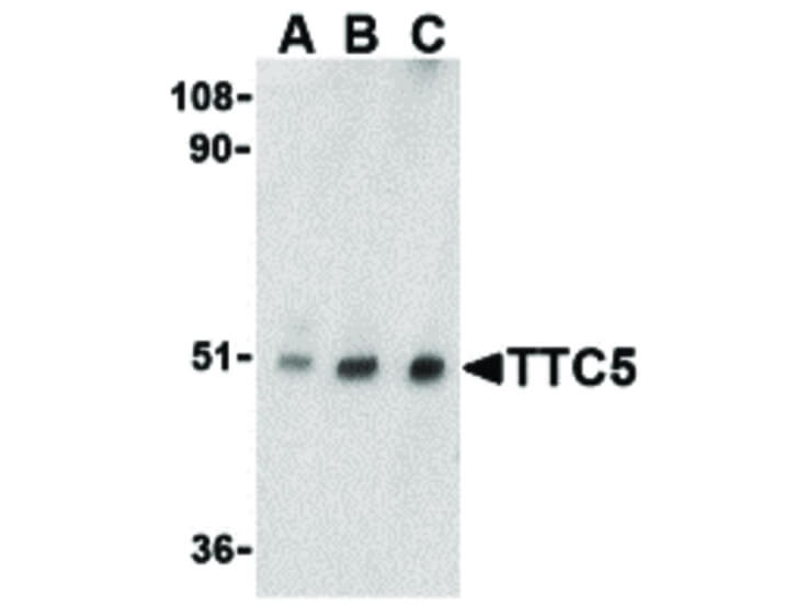 Western Blot of TTC5 Antibody