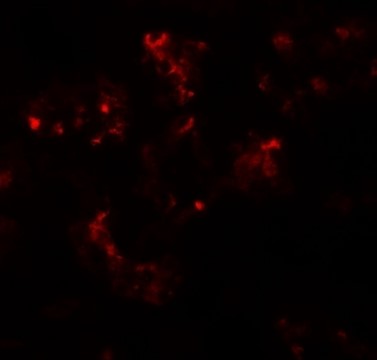 Immunofluorescence of TTYH2