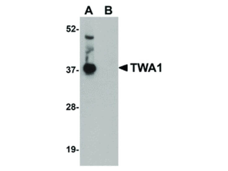 Western Blot of TWA1 Antibody