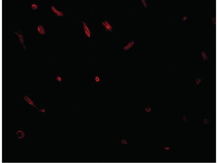 Immunofluorescence of TWA1 Antibody