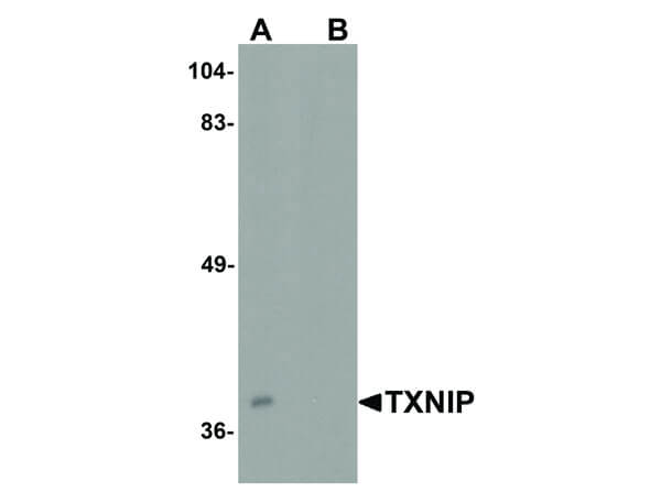 Western Blot of TXNIP Antibody