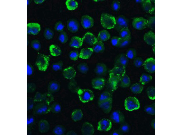 Immunofluorescence of TYK2