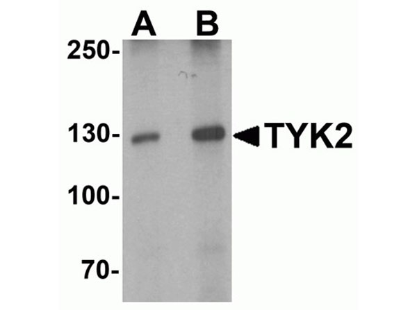 Western blot analysis of TYK2