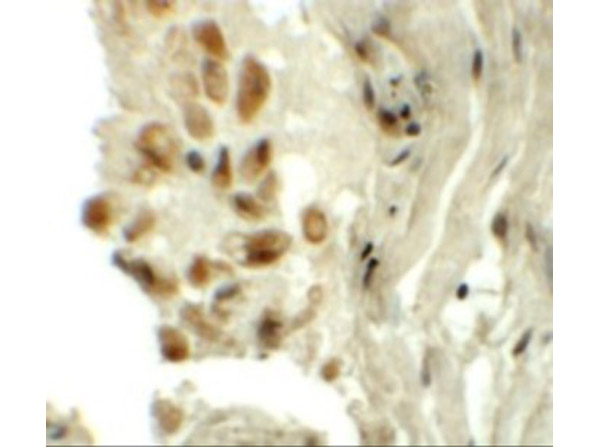 Immunohistochemistry of TYW1