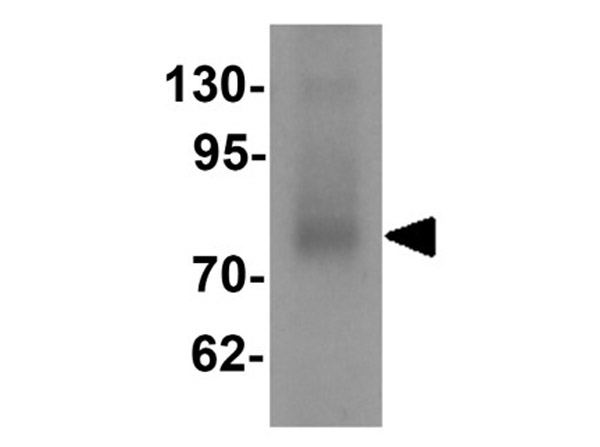 Western blot analysis of TYW1