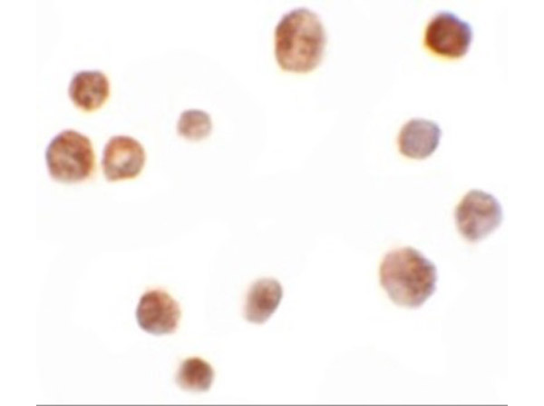 Immunocytochemistry of TYW2.