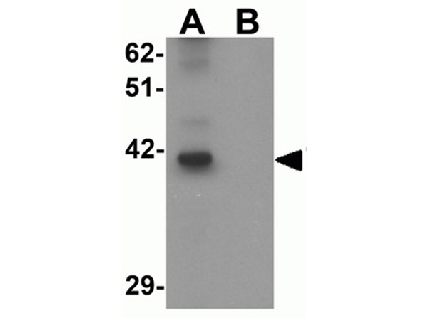 Western blot analysis of TYW2.