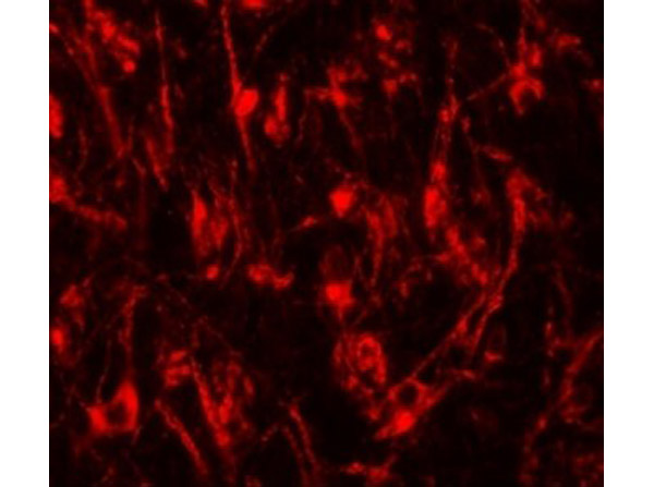 Immunofluorescence of TYW4