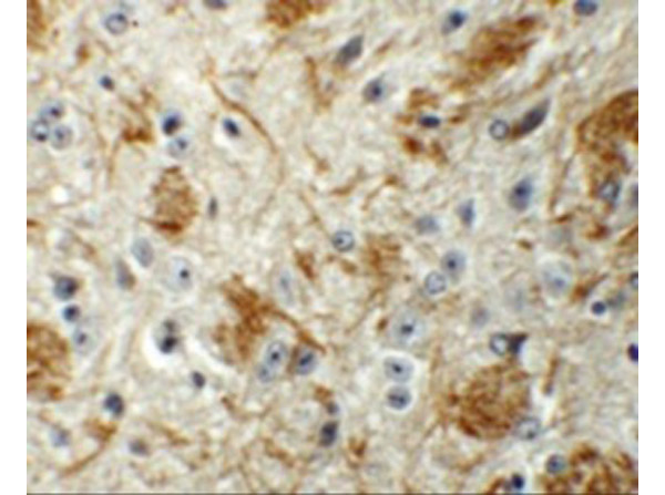 Immunohistochemistry of TYW4