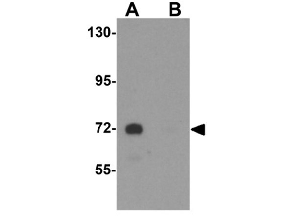 Western blot analysis of TYW4