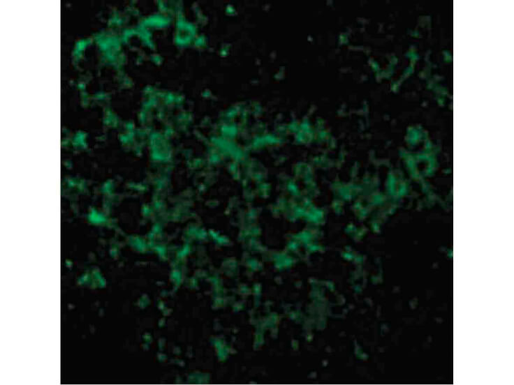 Immunofluorescence of UBC13 Antibody