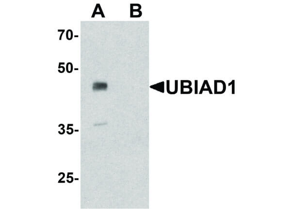 Western Blot of UBIAD1 Antibody