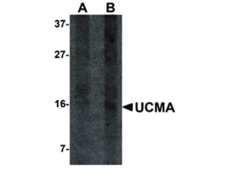 Western Blot of UCMA Antibody