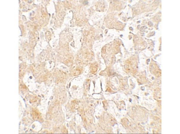 Immunohistochemistry of UCP1