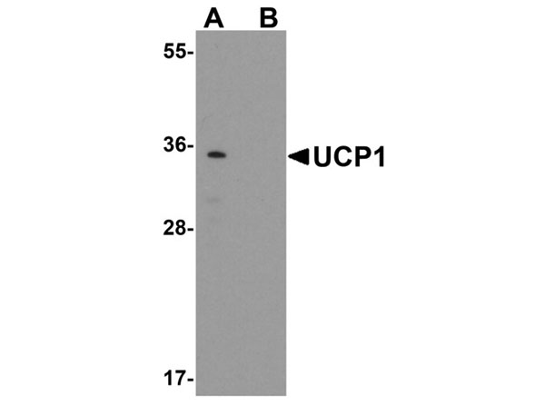 Western blot of UCP1