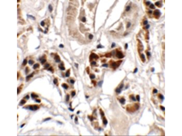 Immunohistochemistry of UHRF1BP1