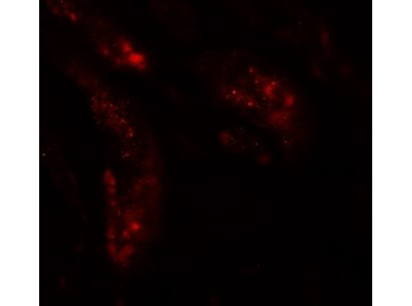 Immunofluorescence of UHRF1BP1L