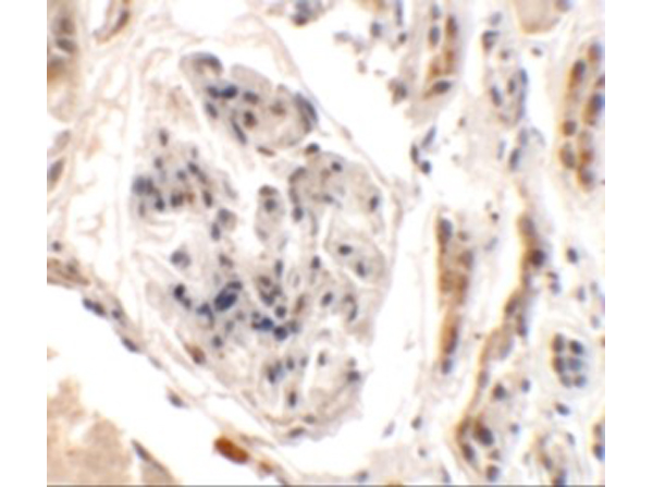 Immunohistochemistry of UHRF1BP1L