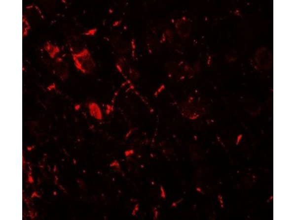 Immunofluorescence of ULK1