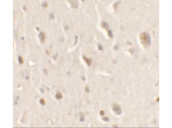 Immunohistochemistry of ULK1