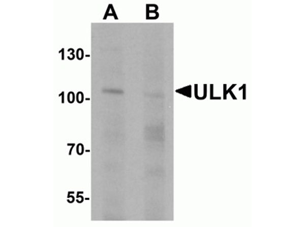Western blot of ULK1